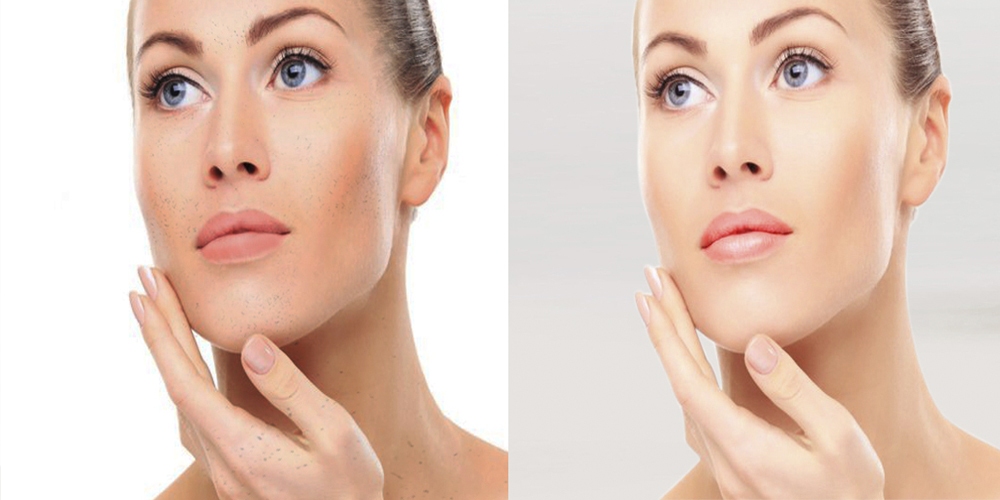 Photo Retouching Services